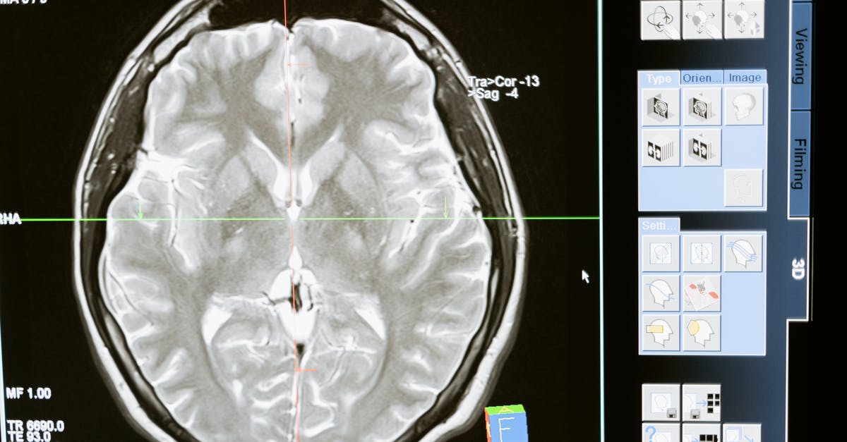 How did the bullet lodged in his brain affect Bazil in Micmacs? - Free stock photo of analysis, anatomy, brain