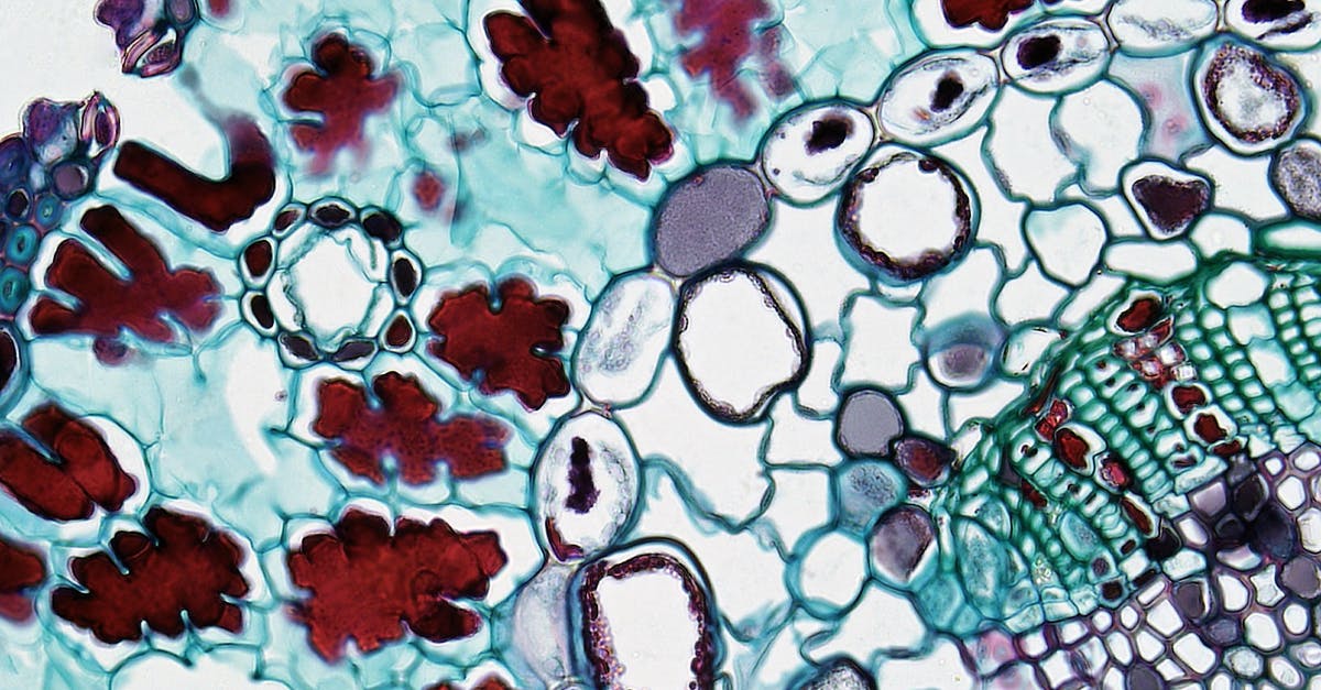 What are the "ghosts" seen by Marianne? - Cell Seen Under Microscope