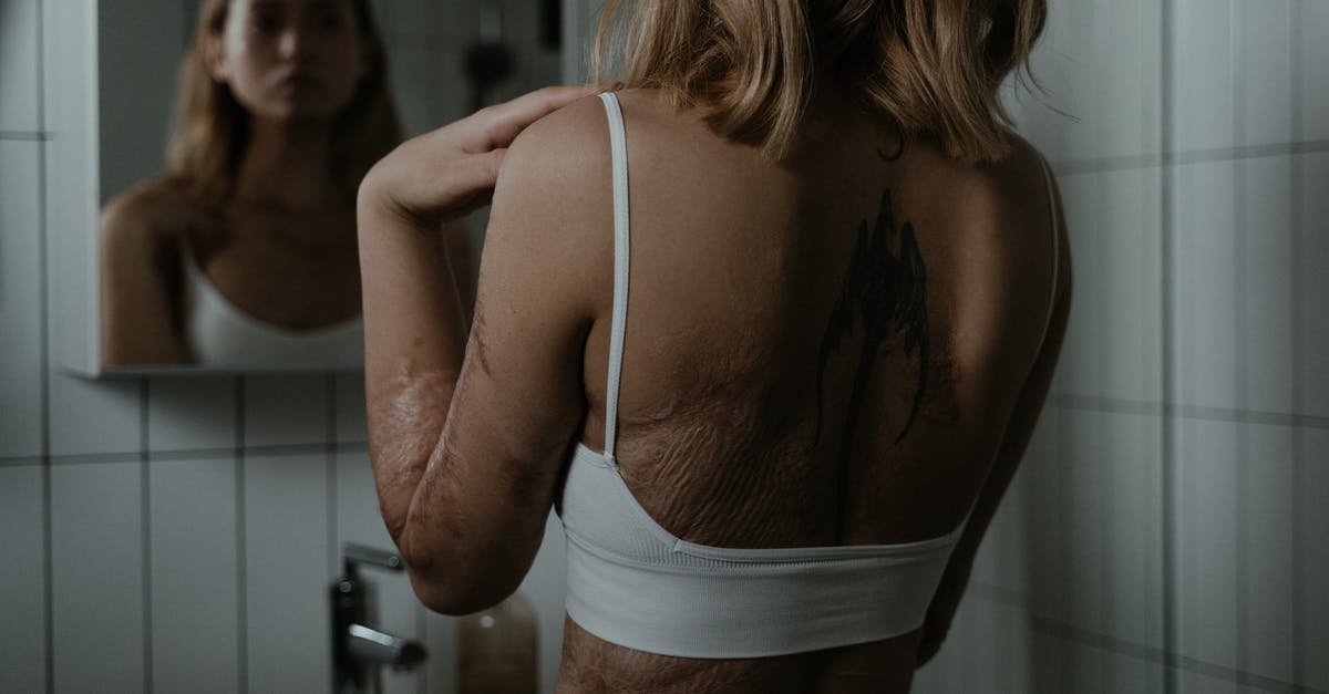 What do the scars on Brad Pitt's back mean in Fury? - 
A Woman with Scars on Her Body