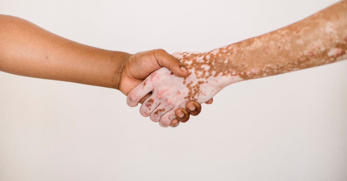 What is this symbolism? - Crop anonymous man shaking hand of male friend with vitiligo skin against white background