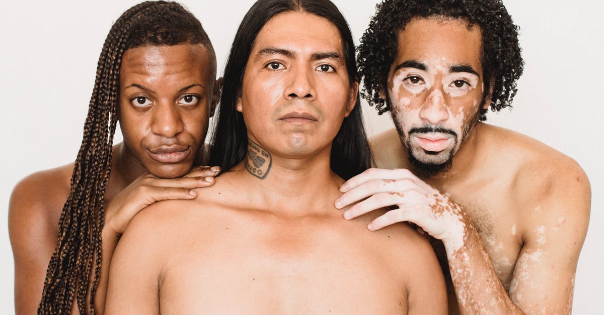 Why does Jules use gay men to "conquer femininity"? - Young black man with vitiligo skin condition standing close to partner with Afro braids and serious ethnic friend while looking at camera